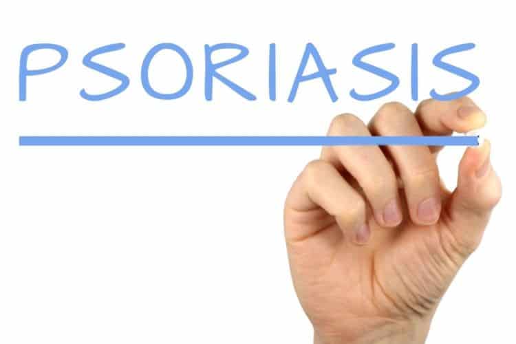 Psoriasis y ejercicio físico 1 psoriasis