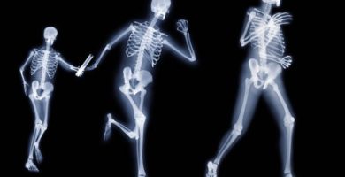 Osteoporosis y Actividad Física