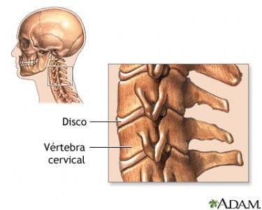 Vértebras que componen el cuello