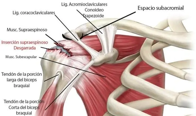 tendones del hombro