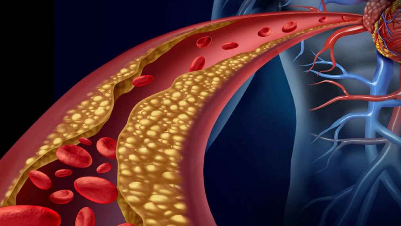 pautas de ejercicio de acsm para diabetes tipo 2