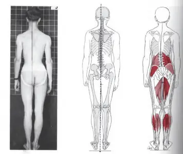Fotografía de planos de importancia para el análisis de la postura estática.