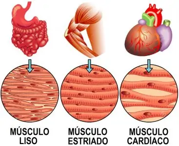 Tipos de músculos y sus diferencias anatómicas.