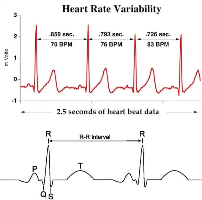 Figura 2. Variabilidad cardíaca