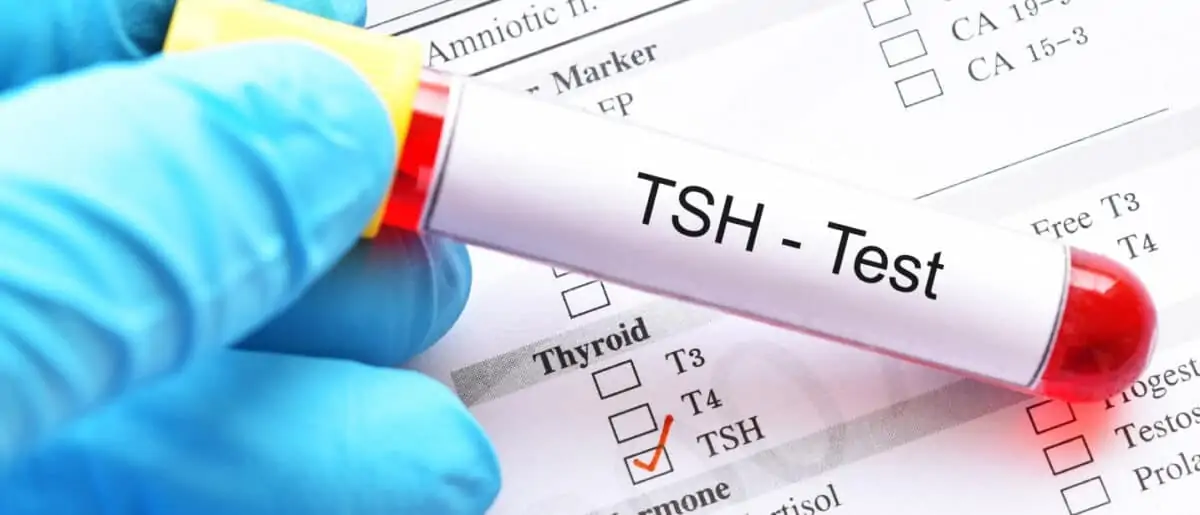 hormona TSH