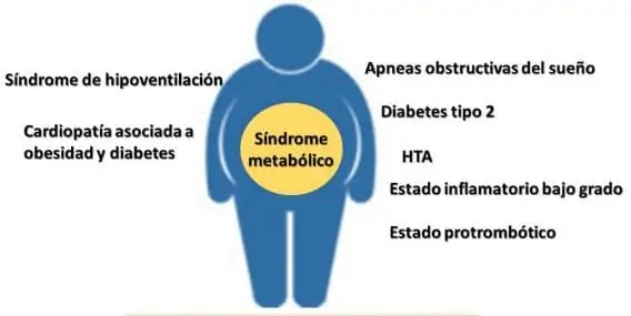 obesidad y coronavirus.
