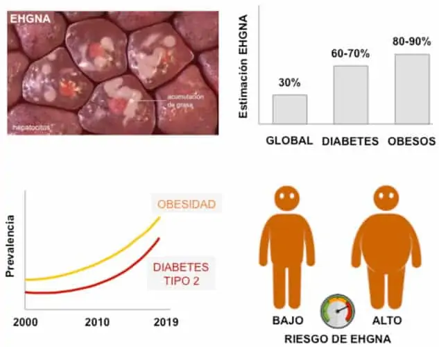 Obesidad y síndrome metabólico con mayor predisposición a hígado graso no alcohólico.