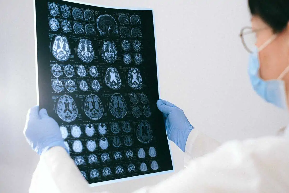 Imagen de resonancia magnética de cerebro