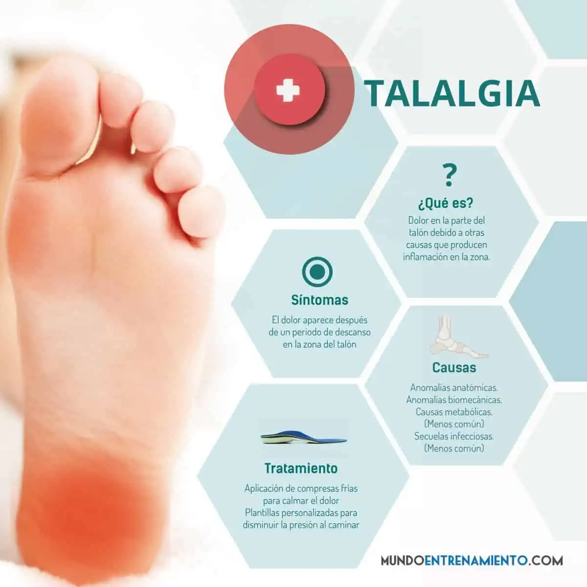 infografia talalgia
