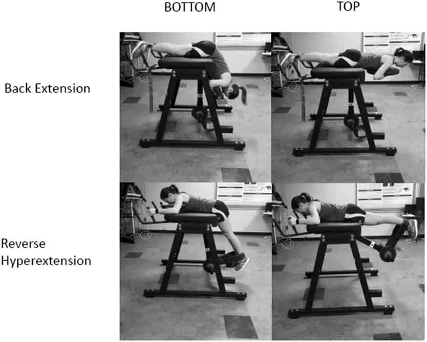 hiperextensiones lumbares