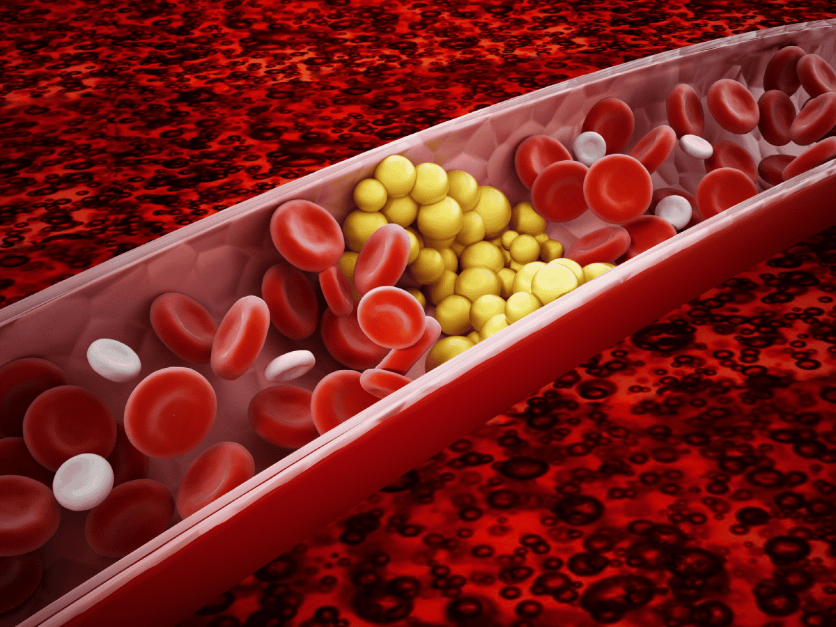 Triglicéridos en la sangre