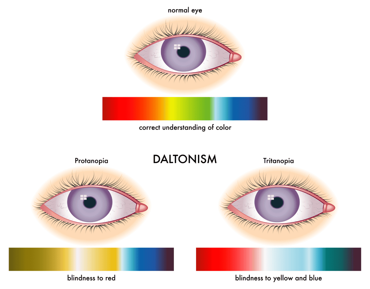 Daltonismo frente a una visión normal