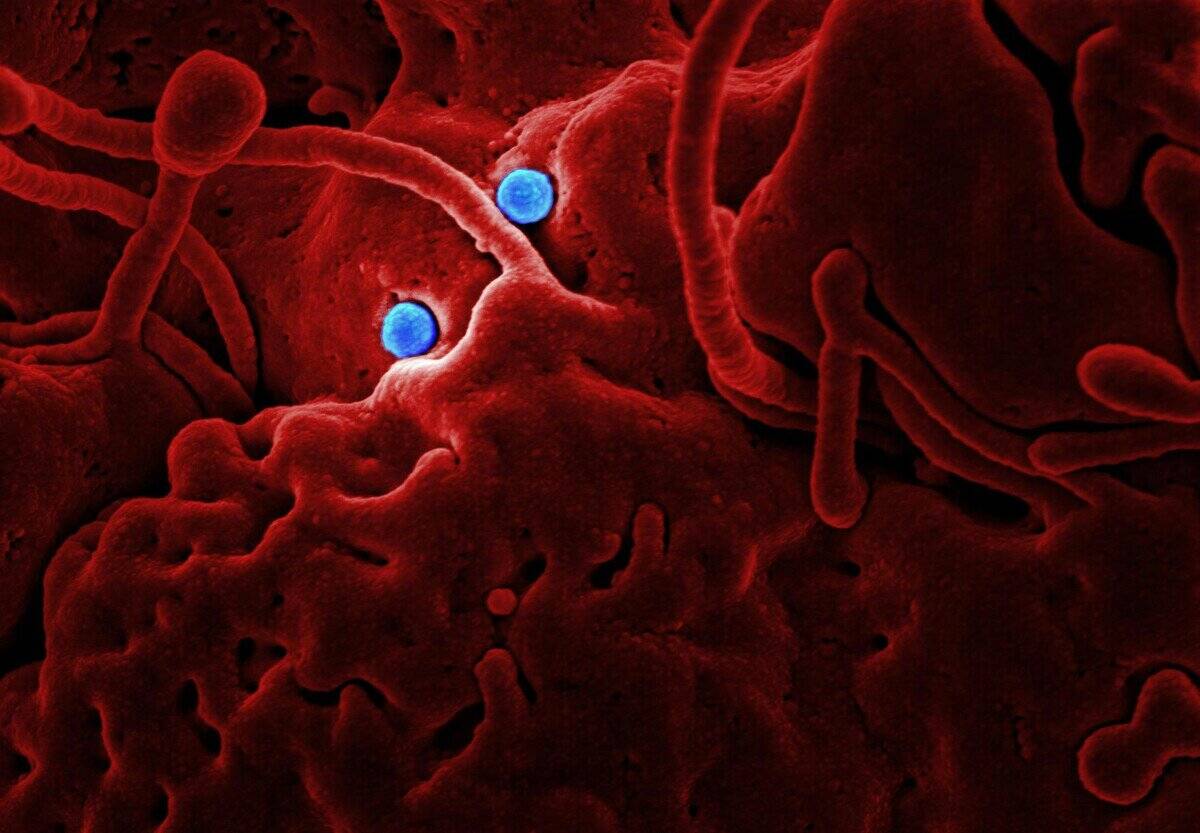 globulos rojos