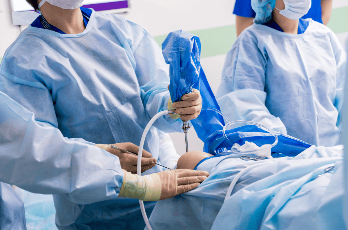 Hombro dislocado: síntomas, causas y tratamientos Cirugía con artroscopia