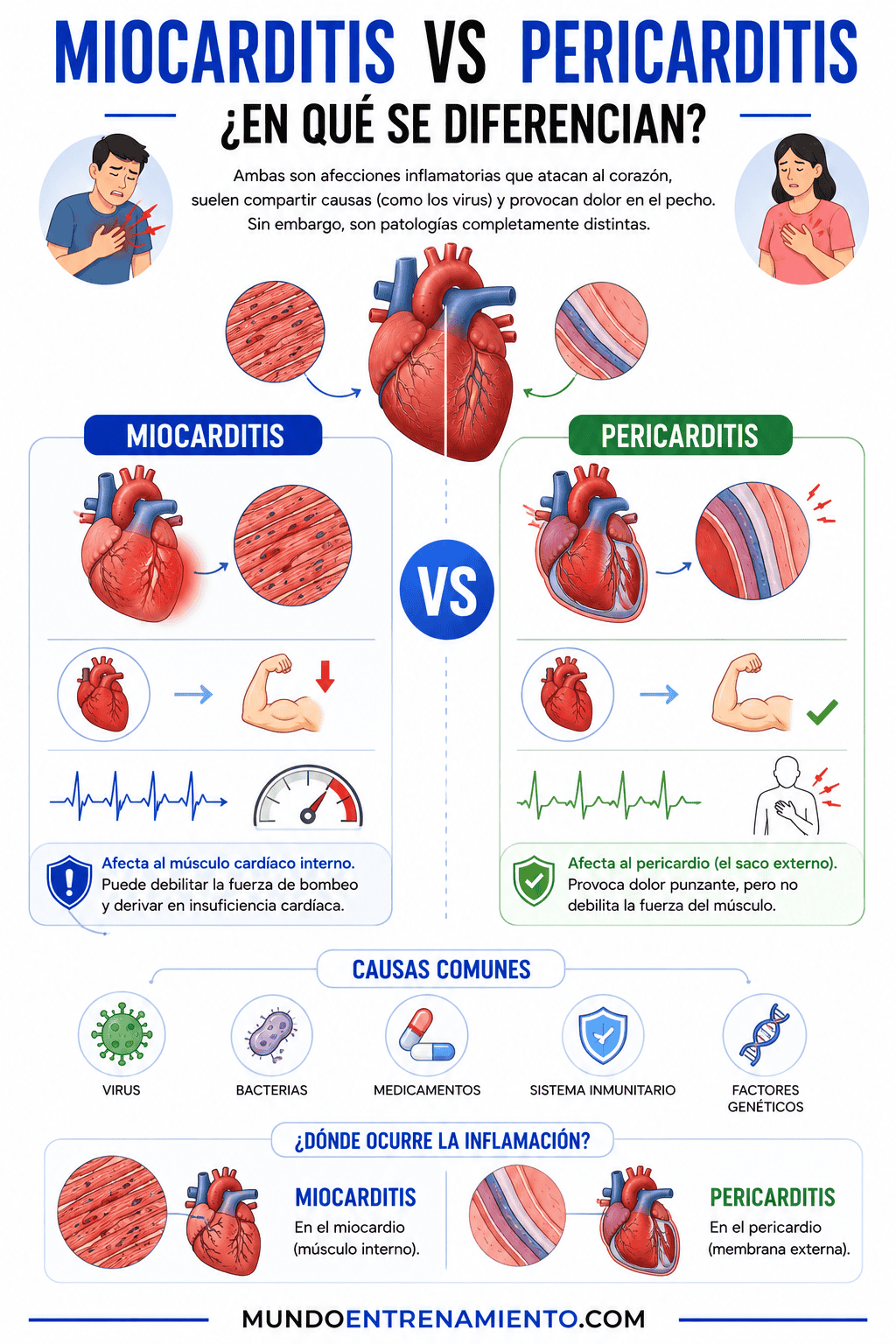 Miocarditis qué es, síntomas de alerta y cómo se cura Diferencias miocarditis vs pericarditis