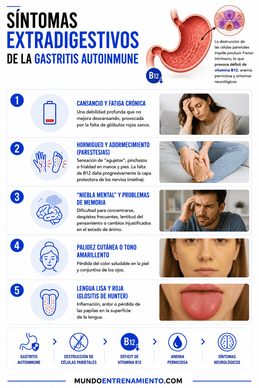 Gastritis autoinmune y Hashimoto: destrucción vitamina b12 Síntomas gastritis autoinmune