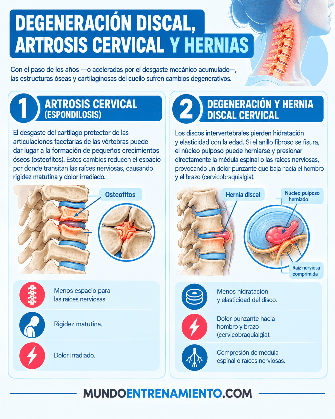 Dolor cervical: causas, alivio y cuándo preocuparte Dolor cervical degeneración