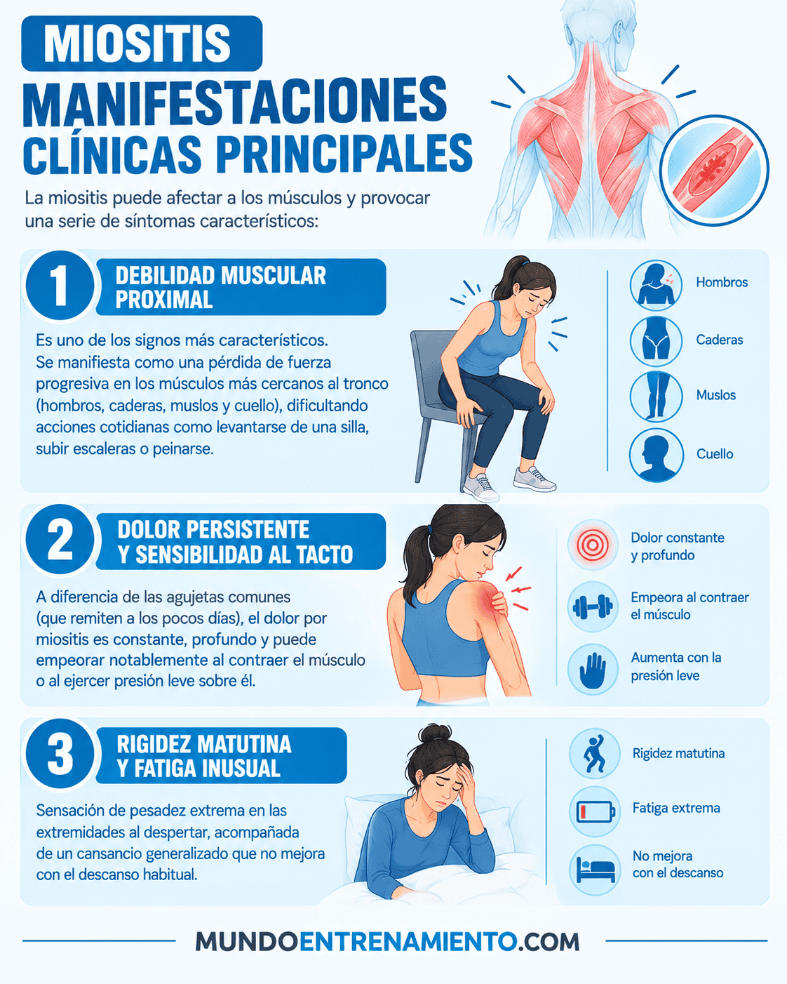 Miositis qué es y cómo afecta al rendimiento deportivo Sintomas miositis
